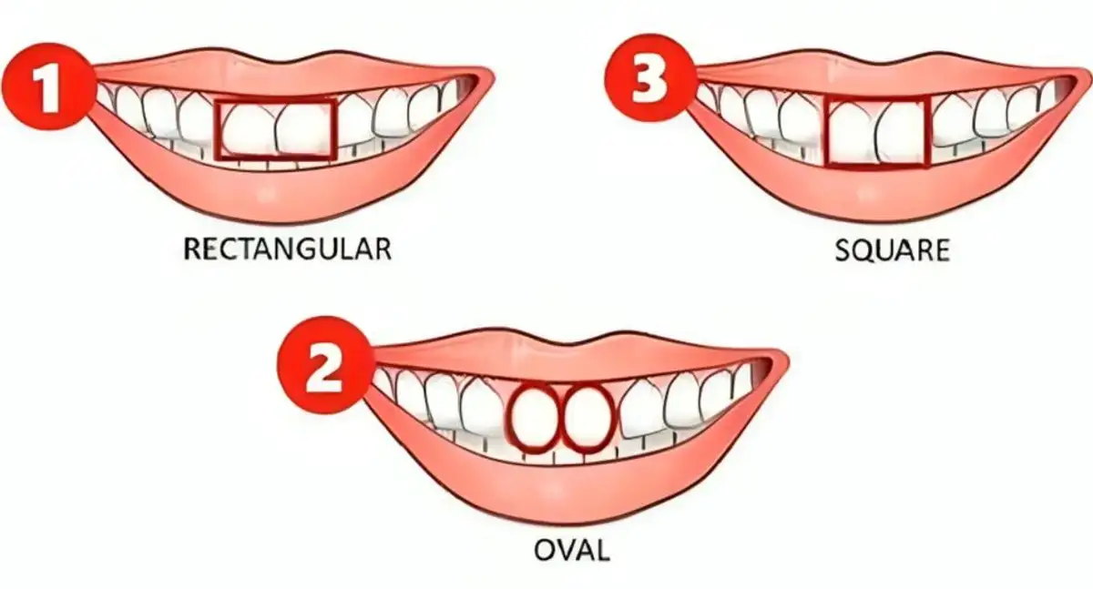 Decouvre Qui Tu Es Vraiment En Fonction De La Forme De Tes Dents !